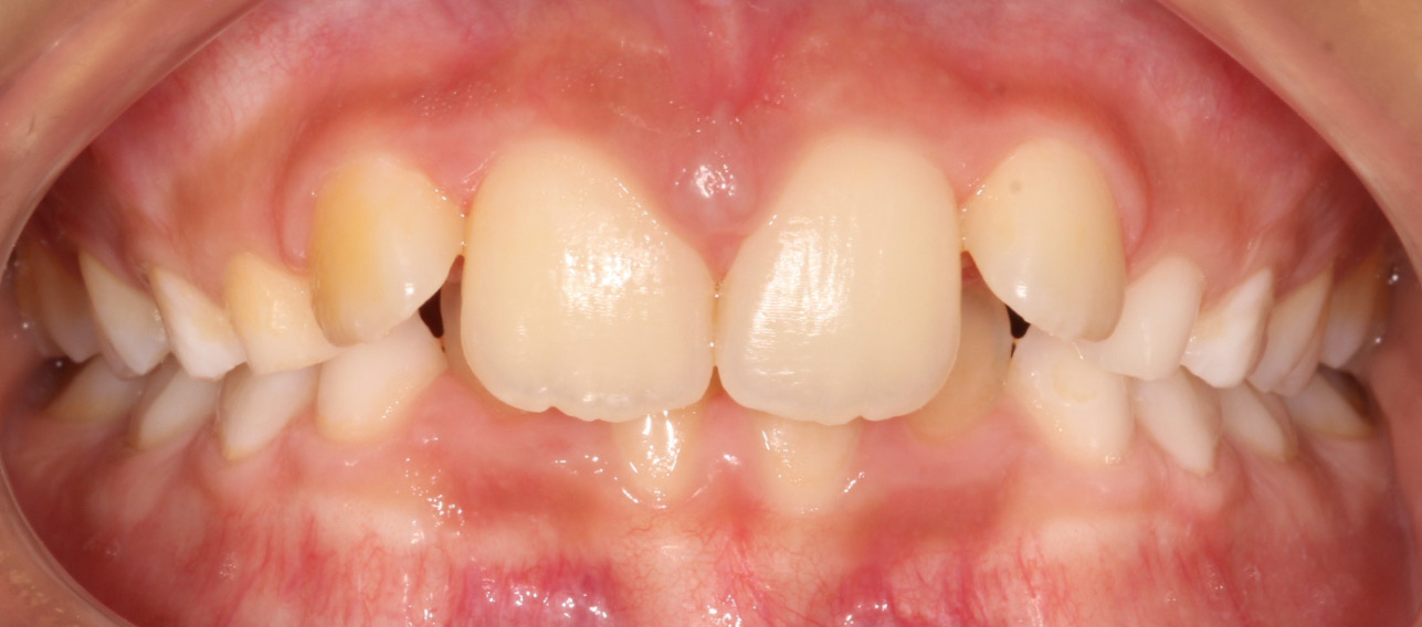 Before image