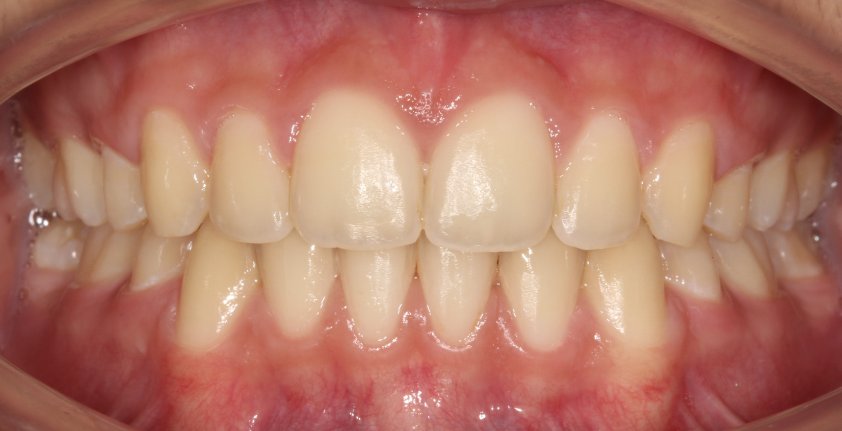After image