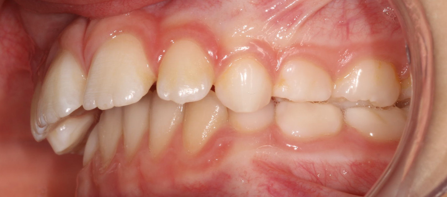 Before image