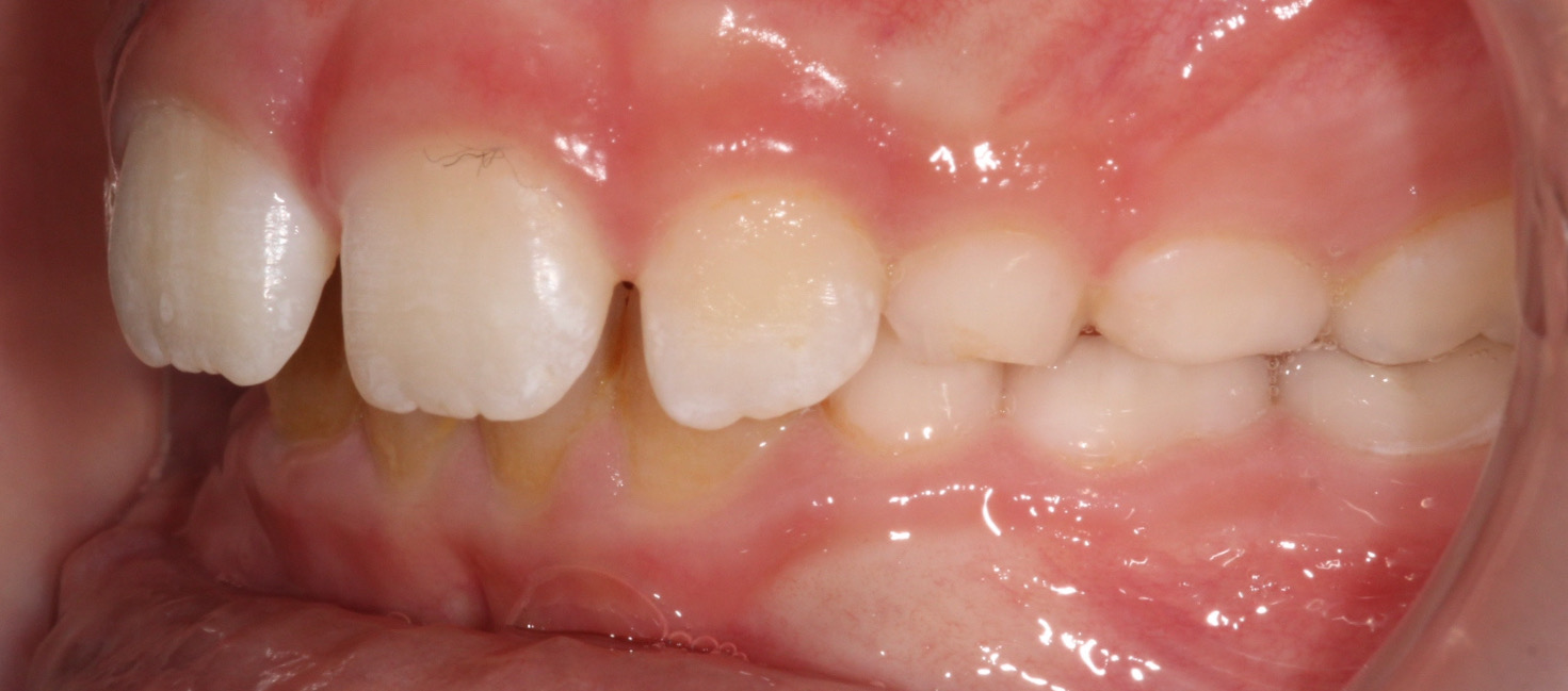 Before image