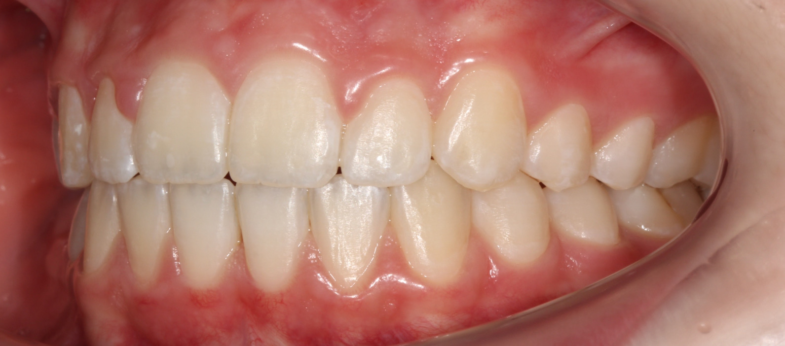 After image