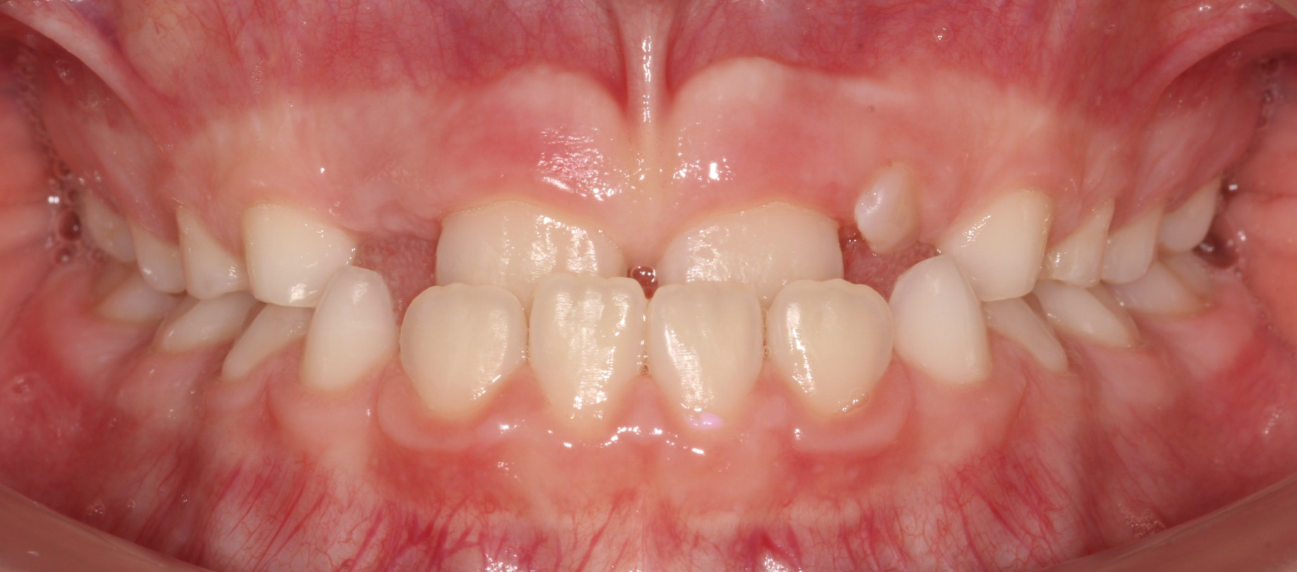 Before image