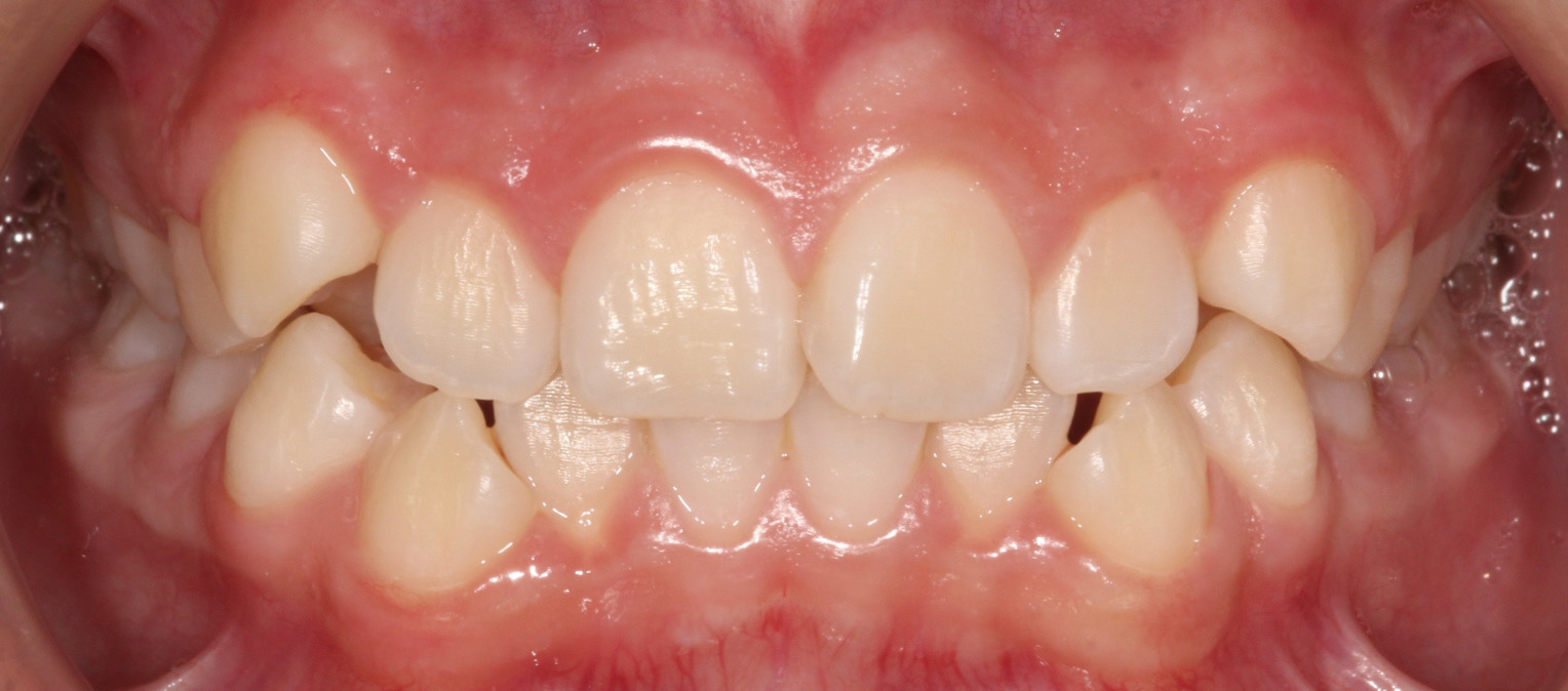 Before image