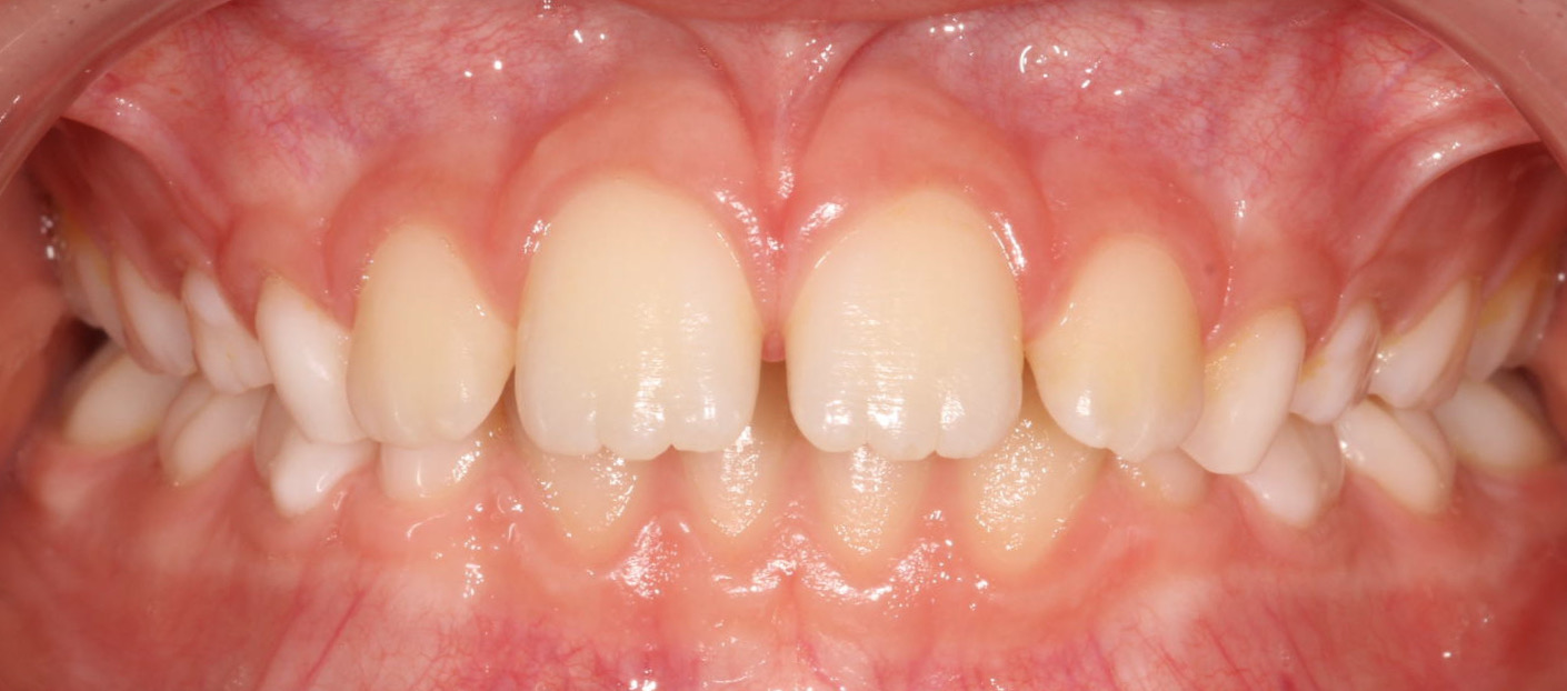 Before image
