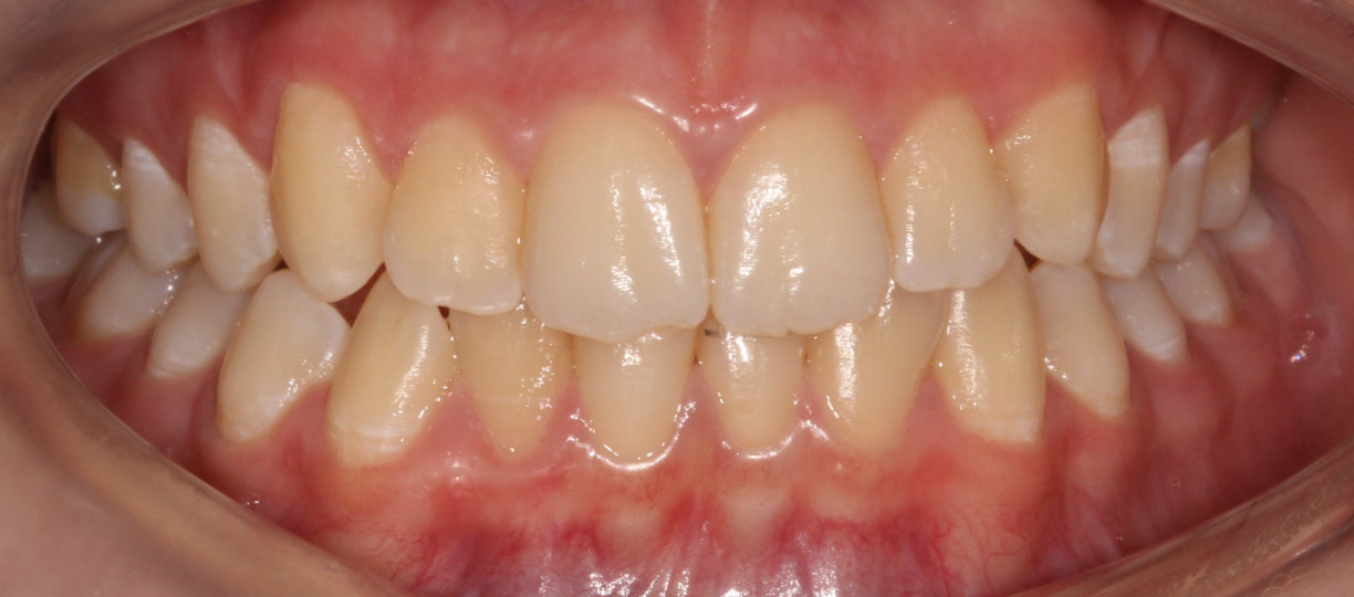 Before image